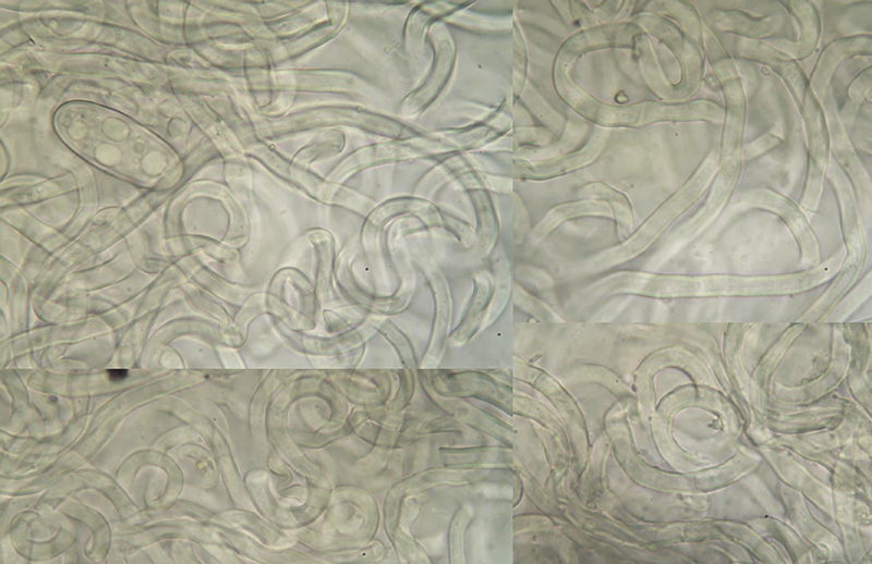 Sarcoscypha austriaca hairs